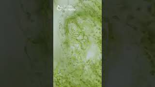 Anabaena azollae en cavidad foliar de Azolla sp Corte a mano [upl. by Pax]