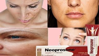 Neoprosone skin brightening cream reviewshmcorner [upl. by Weikert325]