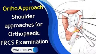 OrthoApproach  Shoulder approaches for Orthopaedic FRCS Examination [upl. by Engle]