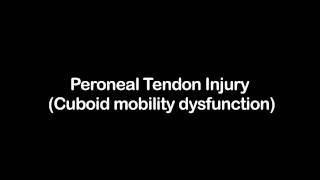 Peroneal Tendon Injury Cuboid mobility dysfunction [upl. by Akaya248]