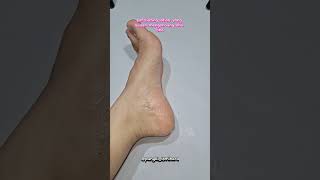 Prepare foot exfoliating lotion skincare prepare preparefootexfoliatinglotion perawatankaki [upl. by Asiela]