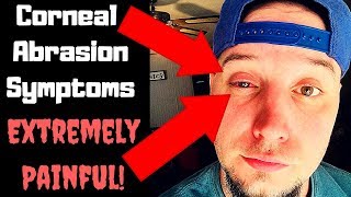 Corneal Abrasion Symptoms amp Treatment  My Ongoing Painful Situation [upl. by Suzan66]