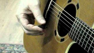 6Guitarist and hand dystonia difficulty holding the plectrum [upl. by Gnehc]