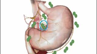 Ganglios abdominales [upl. by Allisan]