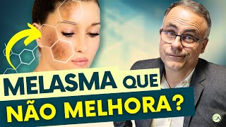 MELASMA 4 DICAS PODEROSAS para CLAREAR sua PELE [upl. by Fortunia]