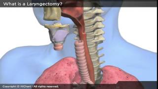 A0001a en A patient´s Guide to Total Laryngectomy Part 1 What is a Laryngectomy [upl. by Wilmar239]