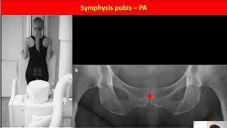 12 Symphysis pubis [upl. by Lessard]