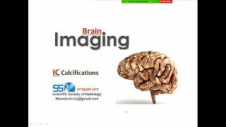 13 Intracranial Calcification imaging  Prof Mamdouh Mahfouz [upl. by Eilesor]