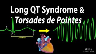 Long QT Syndrome and Torsades de Pointes Animation [upl. by Romilda664]