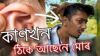 Is my Ear Okay  ঠিকে আছে নে মোৰ আপোনাৰ কাণ  Dimpu Baruah [upl. by Durer570]