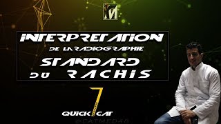 QUICK EP 1  INTERPRÉTATION DUNE RX ST DU RACHIS [upl. by Machute]