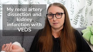 My Renal Artery Dissection and Kidney Infarction with VEDS Vascular EhlersDanlos Syndrome [upl. by Trub969]