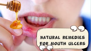 How To Relieve Mouth Ulcers Naturally And Effectively Natural Remedies For Mouth UlcersCanker Sore [upl. by Llezniuq]