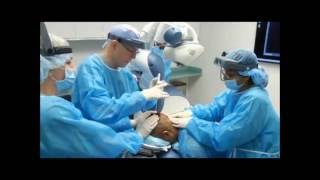 Robotic Hair Transplant Graft Harvesting with ARTAS FUE System [upl. by Annaira]