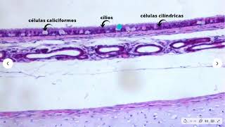 Tecido epitelial pseudoestratificado cilíndrico ciliado com células caliciformes [upl. by Marlow]