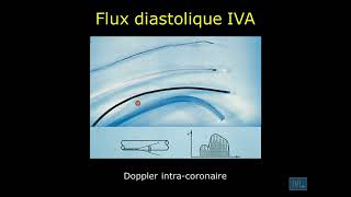 17  Physiologie cardio vasculaire partie 17 [upl. by Nata853]