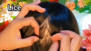 ASMR Satisfying I will help remove your fleas  No Talking 😴💤🥱 [upl. by Mayce]