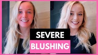 MY PERSONAL EXPERIENCE WITH BLUSHING TO MY FELLOW BLUSHERS [upl. by Ceevah]