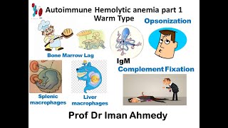 Autoimmune Hemolytic Anemia part 1 Warm type [upl. by Golub]