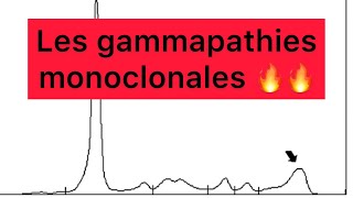 📍Les Gammapathies Monoclonales 🔥🔥  khadidja ferdj 🔥 [upl. by Elcarim543]