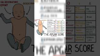 Apgar scorenidhigupta4338 sorto sortvideo sortviral explore subscribers [upl. by Fagaly373]