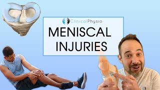 Meniscal injuries and Meniscus Tears  Expert Review on Assessment and Treatment [upl. by Macur]