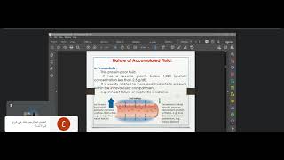 pathology  Homeostasis  Hemodynamic Edema oedema part 1 [upl. by Eidaj]