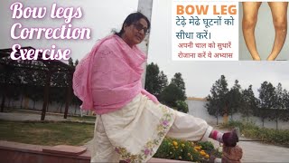 Bow legs correction exercise  टेड़े मेड़े घुटनों को 6 महिने में सीधा करें 🙏 [upl. by Wasson]