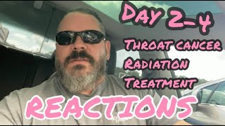 WHAT TO EXPECT  Throat Cancer  Radiation Treatment to cure my cancer  My Reactions Day 24 [upl. by Ahsiekram]