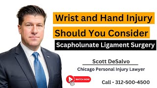 Wrist and Hand Injury  Should I Do Surgery Scapholunate Ligament Repair  Call 3125004500 [upl. by Llevra]