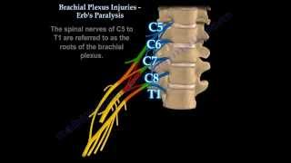 Brachial Plexus Injuries Erbs Paralysis  Everything You Need To Know  Dr Nabil Ebraheim [upl. by Elleirua139]