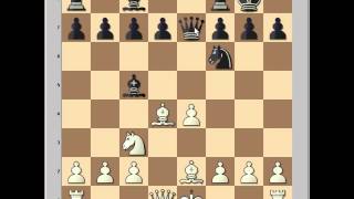 Chess Tactics Undermining Colias B vs Ronco J [upl. by Cummins]