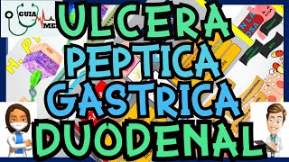 ÚLCERA PÉPTICA GÁSTRICA Y DUODENAL  GuiaMed [upl. by Oneill585]