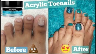 FOOT TRANSFORMATION How I extend my short Toenails using Acrylic without TIP   PEDICURE at Home [upl. by Ynots]