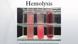 Hemolysis [upl. by Lyj]