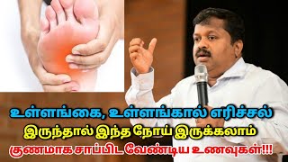 கைகால் எரிச்சல் குணமாக சாப்பிட வேண்டிய உணவுகள்  DrSivaraman  Kai kaal erichal kunamaga [upl. by Pirali168]