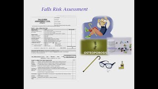 FALL RISK ASSESSMENT FOR OSCE [upl. by Madid]