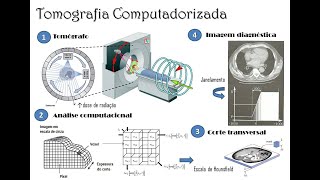 Tomografia Computadorizada  Tópicos gerais [upl. by Cusick601]