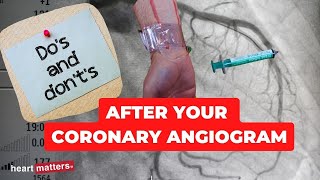 Clinical Anatomy  Cardiac Coronary Vessels left and right coronary artery venous sinus [upl. by Pamella47]