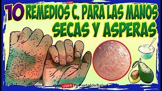 10 Remedios Caseros para las Manos Secas y Asperas Como Tener Manos Suaves e Hidratadas [upl. by Duntson126]