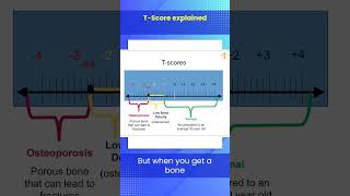 TScore Explained [upl. by Magavern]