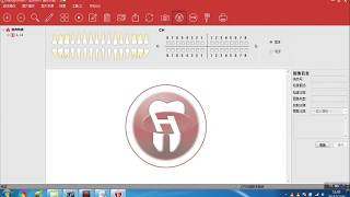 Dental RVG Sensor Software Installation Instructions  Yuesen Med [upl. by Quita]