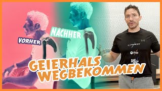 quotGeierhals So wirst du Nacken und Schulterschmerzen losquot [upl. by Ahron705]