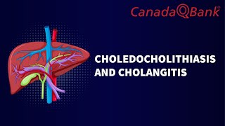 Choledocholithiasis amp Cholangitis [upl. by Anika]