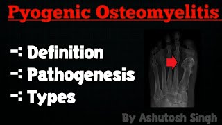 OSTEOMYELITIS Pathology [upl. by Ilke813]