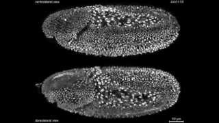 ANTERIORPOSTERIOR AXIS FORMATION IN DROSOPHILA PART2  CSIR NET DEVELOPMENTAL BIOLOGY [upl. by Ordnasela]