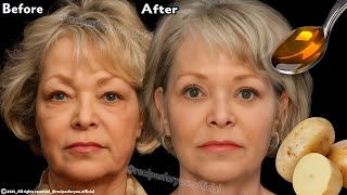 collagen stimulation even if you are 70 years old apply it to wrinkles and they will disappear 🥔 [upl. by Linell]