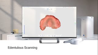 Edentulous Scanning [upl. by Lourdes]