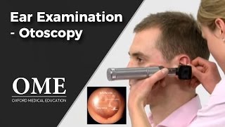 Otoscopy Ear Examination  ENT [upl. by Mari]