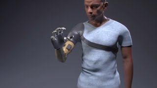 Bionic Arm That Restores Natural Movements Sensation and Touch [upl. by Nimra58]